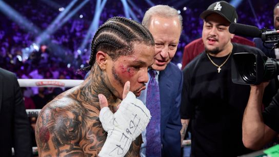 Gervonta Davis shows off the wounds of battle. Gervonta Davis shows off the wounds of battle.